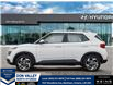 2026 Hyundai Venue Ultimate w/Black Interior (IVT) (Stk: 16105067) in Markham - Image 3 of 24
