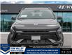 2026 Hyundai Kona 1.6T N Line (Stk: 16105583) in Markham - Image 2 of 24