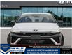 2026 Hyundai Elantra N Base (Stk: 16105461) in Markham - Image 2 of 25