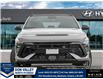 2026 Hyundai Kona 1.6T N Line (Stk: 16105709) in Markham - Image 2 of 24