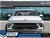 2026 Hyundai Sonata Hybrid Preferred-Trend (Stk: 16105721) in Markham - Image 2 of 25 2026 Hyundai Sonata Hybrid Preferred-Trend (Stk: 16105721) in Markham - Image 2 of 25