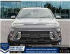 2026 Hyundai Kona 2.0L Preferred (Stk: 16105787) in Markham - Image 2 of 26