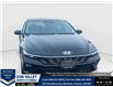 2025 Hyundai Elantra HEV Luxury (Stk: 16U101532) in Markham - Image 1 of 22