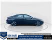 2025 Hyundai Elantra HEV Luxury (Stk: 16U101532) in Markham - Image 10 of 22
